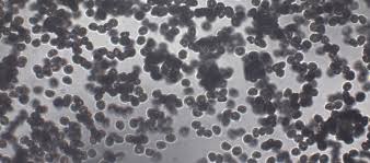 Attēlu rezultāti vaicājumam “Enteridium variabile spores”