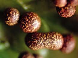 Attēlu rezultāti vaicājumam “Physarum bryocorticola macro”