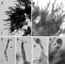 Attēlu rezultāti vaicājumam “Trentepohlia sp.”