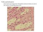 <b>Feline panleukopenia</b>