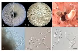 Attēlu rezultāti vaicājumam “Diachea dictyospora (syn. Craterium dictyosporum) spores”