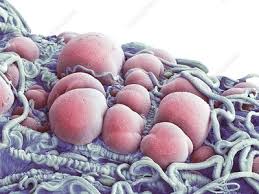 Attēlu rezultāti vaicājumam “undetermined plasmodium”