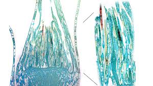 Attēlu rezultāti vaicājumam “Mnium hornum sporophyte”