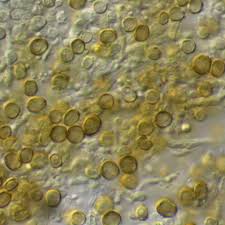 Attēlu rezultāti vaicājumam “Chaenotheca trichialis”