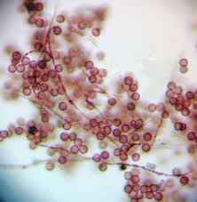 Attēlu rezultāti vaicājumam “Diderma globosum macro”