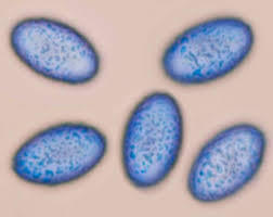 Attēlu rezultāti vaicājumam “Scutellinia scutellata”