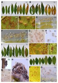 Attēlu rezultāti vaicājumam “Tranzschelia pruni-spinosae spores”