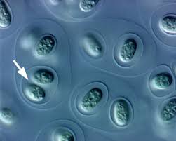 Attēlu rezultāti vaicājumam “Gloeocapsa rupestris”