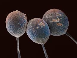 Attēlu rezultāti vaicājumam “Amaurochaete atra”