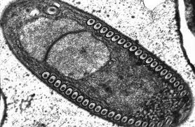 Attēlu rezultāti vaicājumam “Badhamia affinis var. microspora spores”