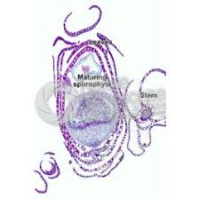 Attēlu rezultāti vaicājumam “Sphagnum centrale sporophyte”