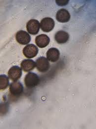 Attēlu rezultāti vaicājumam “Trichia flavicoma spores”