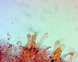 Attēlu rezultāti vaicājumam “Rimbachia neckerae”