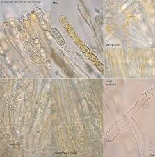 Attēlu rezultāti vaicājumam “Sowerbyella radiculata”