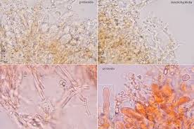 Attēlu rezultāti vaicājumam “Corticium roseum”