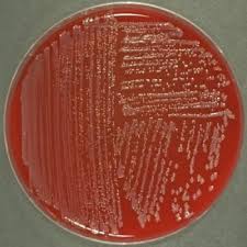 Attēlu rezultāti vaicājumam “Enteridium variabile”