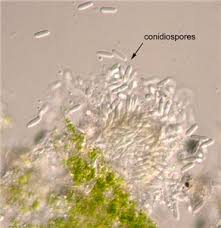 Attēlu rezultāti vaicājumam “Enteridium corticatum spores”