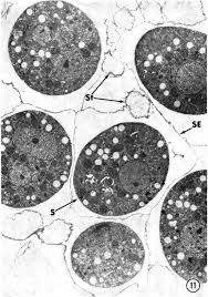 Attēlu rezultāti vaicājumam “Ceratiomyxa fruticulosa young”