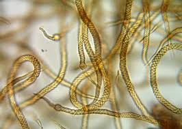 Attēlu rezultāti vaicājumam “Lycogala ustulatum sessile”