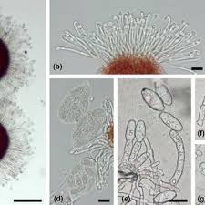 Attēlu rezultāti vaicājumam “Sawadaea tulasnei”