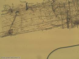 Attēlu rezultāti vaicājumam “Ruzenia spermoides”