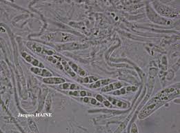 Attēlu rezultāti vaicājumam “Coenogonium pineti”