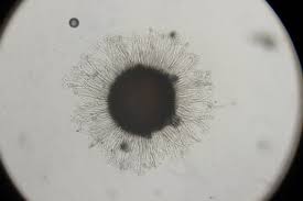 Attēlu rezultāti vaicājumam “Sawadaea tulasnei”