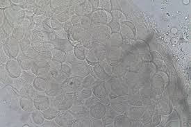 Attēlu rezultāti vaicājumam “Heterotrichia oerstedii (syn. Arcyria oerstedii) sessile”