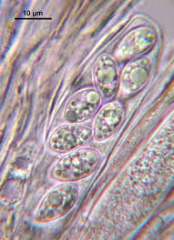 Attēlu rezultāti vaicājumam “Badhamiopsis macrospora”