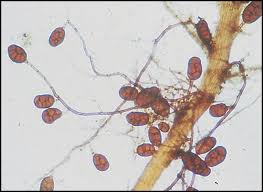 Attēlu rezultāti vaicājumam “Leptobryum pyriforme sporophyte”
