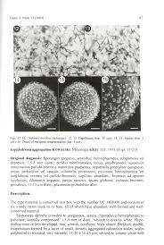 Attēlu rezultāti vaicājumam “Dianema depressum spores”