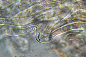 Attēlu rezultāti vaicājumam “Octospora humosa”