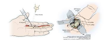 Znalezione obrazy dla zapytania palec