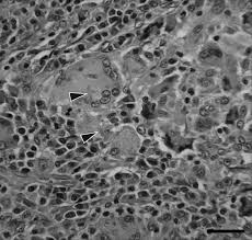 Attēlu rezultāti vaicājumam “Oxyporus corticola”