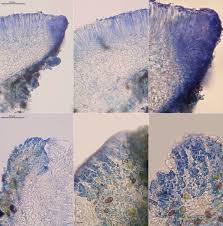 Attēlu rezultāti vaicājumam “Orbilia sp.”