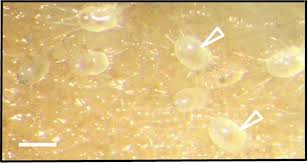 Attēlu rezultāti vaicājumam “Fuligo gyrosa spores”