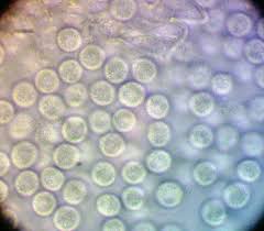 Attēlu rezultāti vaicājumam “Lycogala ustulatum macro”