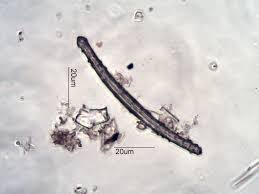 Attēlu rezultāti vaicājumam “Spongilla lacustris”