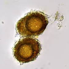 Attēlu rezultāti vaicājumam “Ephemerum serratum”