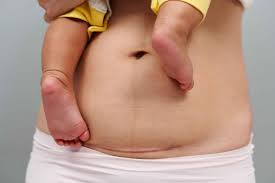 Image result for cesarskie