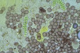 Attēlu rezultāti vaicājumam “Physarum auriscalpium”