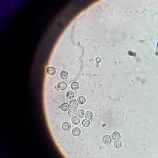 Attēlu rezultāti vaicājumam “Arcyria affinis spores”