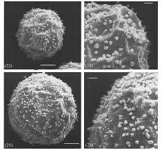 Attēlu rezultāti vaicājumam “Clastoderma debaryanum spores”