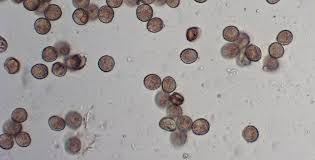 Attēlu rezultāti vaicājumam “Hemitrichia decipiens spores”