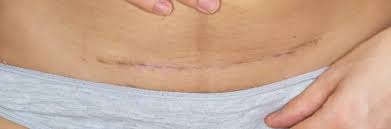 Image result for cesarskie