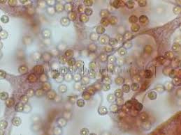 Attēlu rezultāti vaicājumam “Cribraria vulgaris macro”