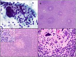 Attēlu rezultāti vaicājumam “Cinclidotus danubicus cells”