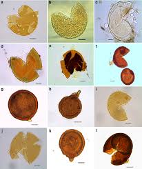 Attēlu rezultāti vaicājumam “Amaurochaete fusiformis spores”