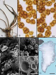 Attēlu rezultāti vaicājumam “Urocystis anemones spores”