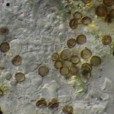 Attēlu rezultāti vaicājumam “Xanthoriicola physciae”